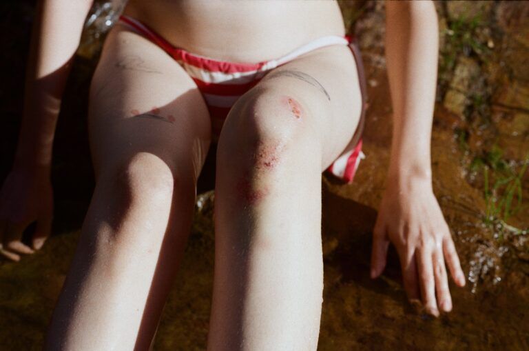 Battered and Bruised